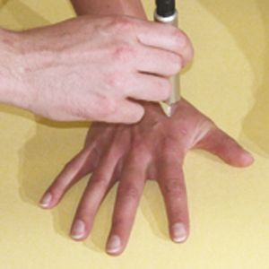 apparecchio-per-laserterapia-professionale-globus-physiolaser-500-3