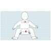 ortesi-per-abduzione-danca-per-bambini-ottobock-tubingen-28l10