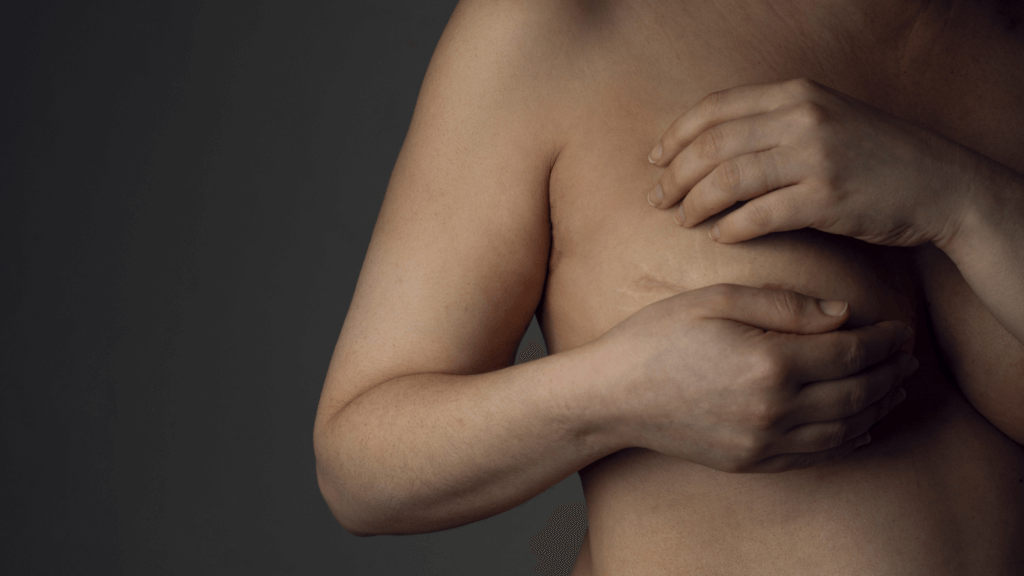 3 consigli per ridurre le cicatrici dopo un intervento al seno