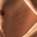 Tendinopatia: Sintomi, Cause e Cura per il Benessere dei Tuoi Tendini