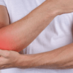 Distorsioni del Gomito: Sintomi, Cause, Trattamenti Efficaci e Cosa Fare