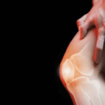 Dolore al Ginocchio Durante l’Adolescenza: Cosa Devi Sapere