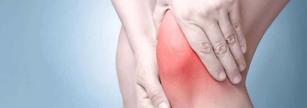 Sindrome Femoro-Rotulea
