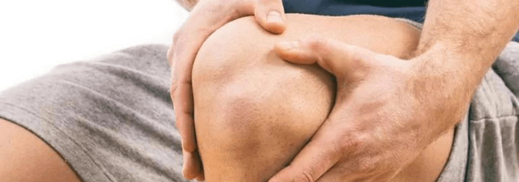 Lateralizzazione della Rotula