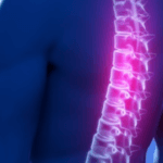 Affrontare le Patologie Degenerative della Colonna Vertebrale per Migliorare il Benessere Spinale