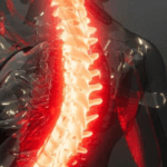 Instabilità Minori della Colonna Vertebrale Lombosacrale: Esplorando le Cause, Sintomi e Possibili Approcci Terapeutici