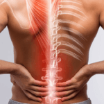 Sindrome del Rachide Lombare: Cause, Sintomi e Trattamenti