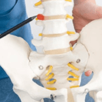 Discectomia: Intervento Chirurgico per la Gestione del Dolore Causato da Ernia del Disco