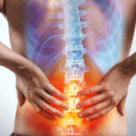 Capire le Fratture Vertebrali Osteoporotiche Stabili: Cause, Sintomi e Gestione