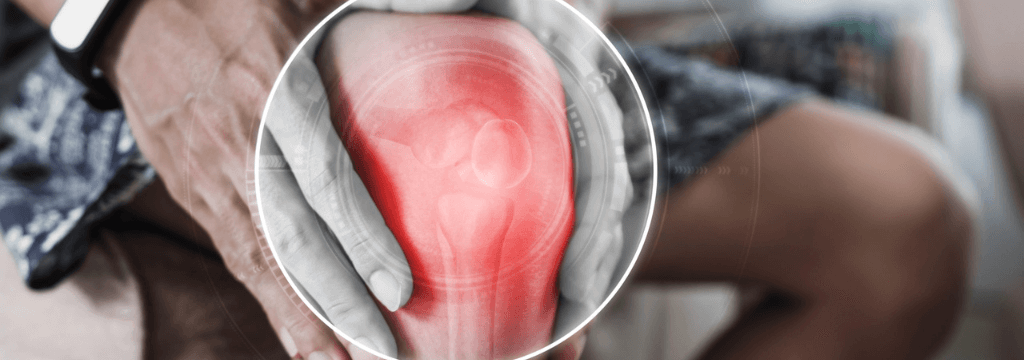 Lesioni ai Legamenti Crociati