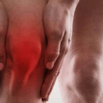 Tendinite Rotulea: Identificazione, Gestione e Recupero