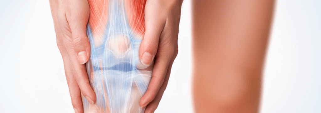 Sindrome Femoro-Rotulea