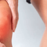 Tendinopatia: Una Guida Completa alla Comprensione e Cura delle Tendinopatie