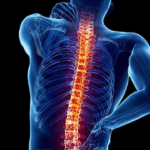 Comprendere l’Artrosi: Sintomi, Cause e Trattamenti Efficaci