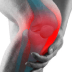 Osteoartrite: Una Guida Completa su Cause, Sintomi e Trattamenti