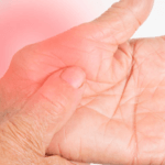 Artrite Reumatoide: Comprensione, Gestione e Trattamento