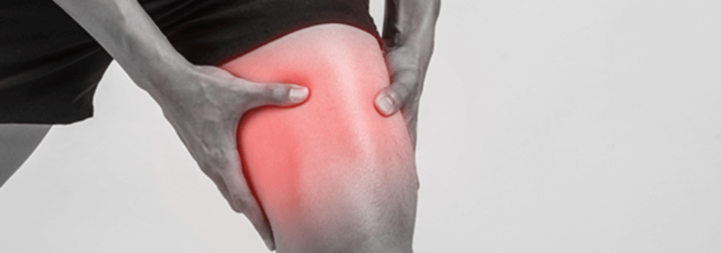 Contusione Muscolare della Coscia