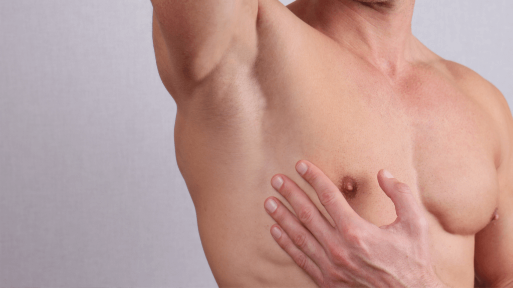 Ginecomastia
