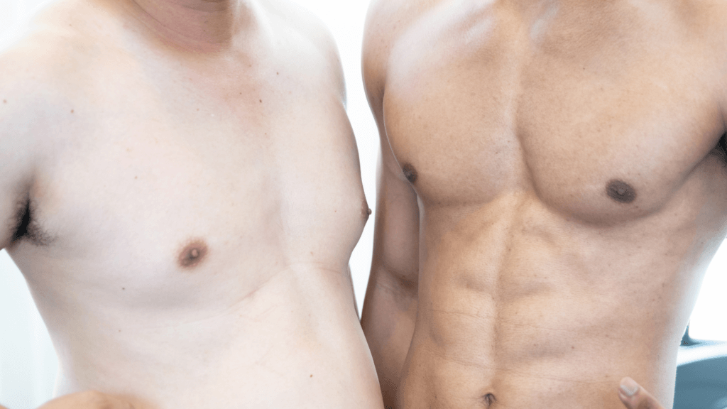 Ginecomastia Uomo