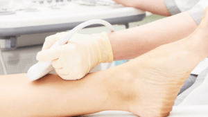 Noleggio Ultrasuono Terapia Roma