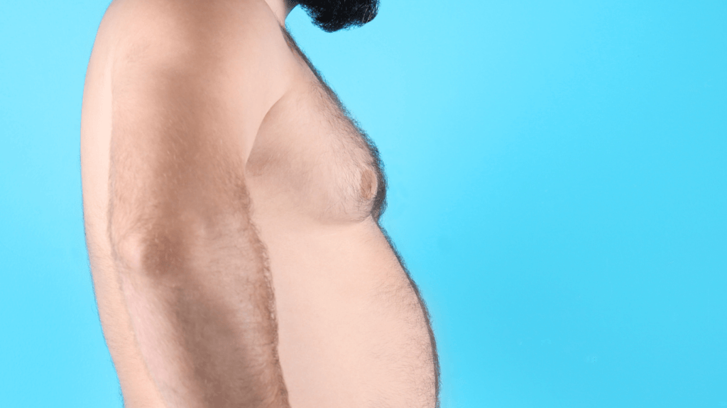 Operazione ginecomastia